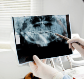 Para médicos radiologistas, oferecemos serviços de radiografia e Raio-X digital de alta qualidade para auxiliar no diagnóstico de uma variedade de condições médicas. Com imagens claras e precisas, você pode identificar problemas de saúde com rapidez e precisão.