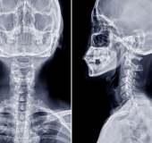 Para médicos pneumologistas e especialistas em saúde ocupacional, disponibilizamos serviços de radiografia de tórax conforme as diretrizes da OIT (Organização Internacional do Trabalho) para avaliar a saúde pulmonar dos trabalhadores expostos a agentes nocivos. Com relatórios especializados e interpretações precisas, você pode identificar e monitorar doenças pulmonares ocupacionais com eficácia.