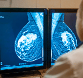 Para ginecologistas e mastologistas, oferecemos serviços de mamografia para o rastreamento e diagnóstico precoce do câncer de mama. Com imagens de alta resolução e interpretações especializadas, você pode detectar anomalias mamárias com precisão e oferecer o tratamento adequado aos seus pacientes.